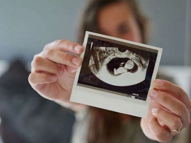 Desarrollo fetal Mujer sosteniendo una imagen por ecografía