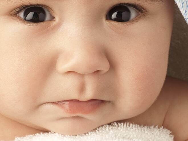 Infecciones en los oídos Infecciones en los oídos