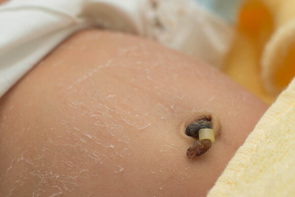 Higiene adecuada para tu bebé pancita de bebé con cordón umbilical